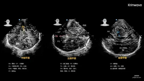 2026纽约时装周焦点：马斯克女儿变性首秀，老爸特征明显